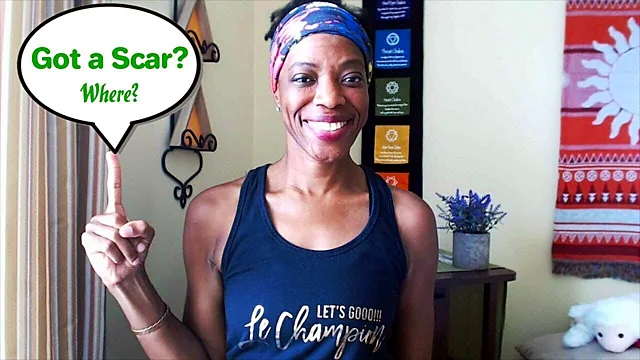 Scars or Marks on Your Body: Where Are They and Why?